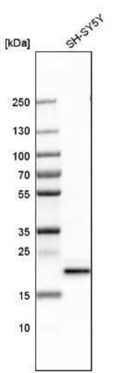 CBX3 Antibody, Novus Biologicals 25 &mu;L | Buy Online | Novus Biologicals | Fisher Scientific