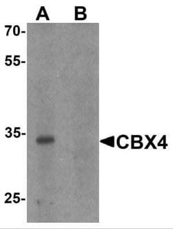 CBX4 Antibody - BSA Free, Novus Biologicals 0.1 mg; Unconjugated:Antibodies,