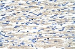 CBX6 Antibody, Novus Biologicals 100 &mu;L; Unconjugated:Antibodies, Polyclonal