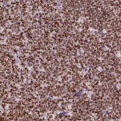 CBY3 Antibody, Novus Biologicals 25 &mu;L, Unconjugated:Antibodies, Polyclonal