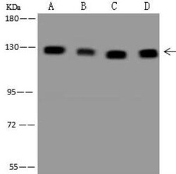 CC2D1A Antibody, Novus Biologicals 50 &mu;g; Unconjugated:Antibodies, Polyclonal
