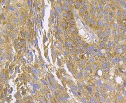 CCDC109A Antibody, Novus Biologicals 100 &mu;g, Unconjugated:Antibodies,