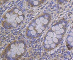 CCDC109A Antibody, Novus Biologicals 100 &mu;g, Unconjugated:Antibodies,