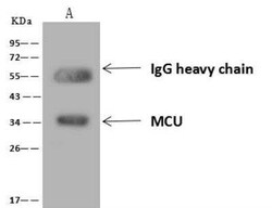 CCDC109A Antibody, Novus Biologicals 100 &mu;g; Unconjugated:Antibodies,