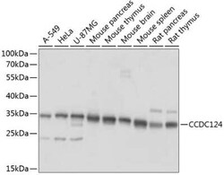 CCDC124 Antibody - Azide and BSA Free, Novus Biologicals:Antikörper:Primärantikörper