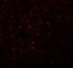 CCDC141 Antibody - BSA Free, Novus Biologicals 0.1 mg | Buy Online | Novus Biologicals | Fisher Scientific