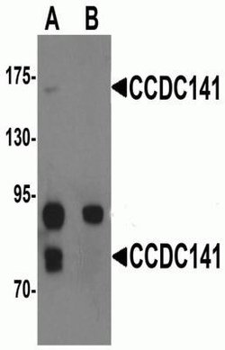 CCDC141 Antibody - BSA Free, Novus Biologicals 0.1 mg | Buy Online | Novus Biologicals | Fisher Scientific