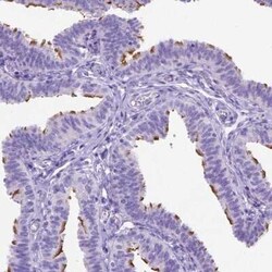 CCDC151 Antibody, Novus Biologicals:Antibodies:Primary Antibodies