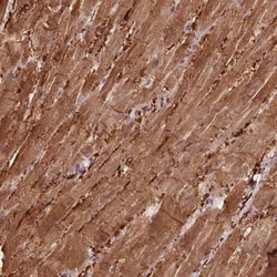 CCDC168 Antibody, Novus Biologicals 25 &mu;L, Unconjugated:Antibodies,