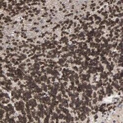 CCDC175 Antibody, Novus Biologicals 0.1 mL | Buy Online | Novus Biologicals | Fisher Scientific