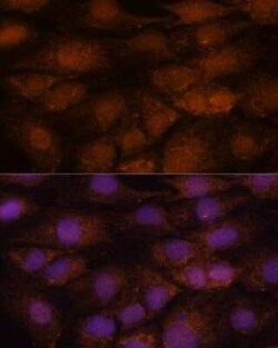 CCDC21 Antibody - Azide and BSA Free, Novus Biologicals 0.1 mL, Unconjugated:Antibodies,