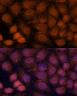 CCDC21 Antibody - Azide and BSA Free, Novus Biologicals 0.1 mL, Unconjugated:Antibodies,