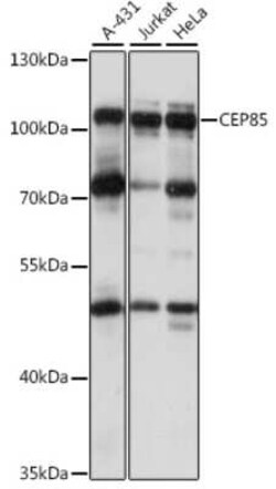 CCDC21 Antibody - Azide and BSA Free, Novus Biologicals 0.1 mL, Unconjugated:Antibodies,