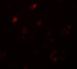 CCDC22 Antibody - BSA Free, Novus Biologicals 0.1 mg; Unconjugated:Antibodies,