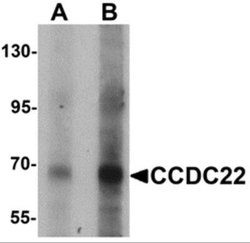 CCDC22 Antibody - BSA Free, Novus Biologicals 0.1 mg; Unconjugated:Antibodies,