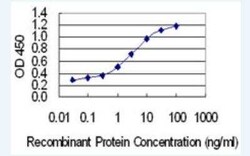 CCDC28A Antibody (6F2), Novus Biologicals 100 &mu;g | Buy Online | Novus Biologicals | Fisher Scientific