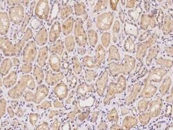 CCDC4 Antibody, Novus Biologicals 100 &mu;g, Unconjugated:Antibodies, Polyclonal