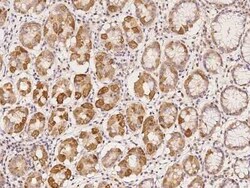 CCDC4 Antibody, Novus Biologicals 100 &mu;g, Unconjugated:Antibodies, Polyclonal