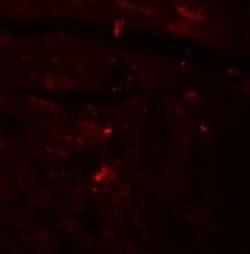 CCDC47 Antibody - BSA Free, Novus Biologicals 0.1 mg; Unconjugated:Antibodies,