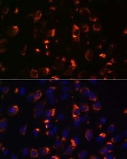 CCDC47 Antibody - Azide and BSA Free, Novus Biologicals:Antibodies:Primary