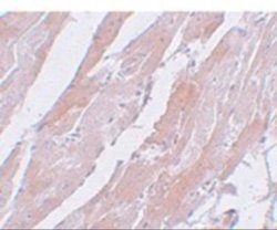 CCDC47 Antibody - BSA Free, Novus Biologicals 0.1 mg; Unconjugated:Antibodies,