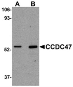 CCDC47 Antibody - BSA Free, Novus Biologicals 0.1 mg; Unconjugated:Antibodies,