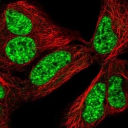 CCDC49 Antibody, Novus Biologicals:Antibodies:Primary Antibodies