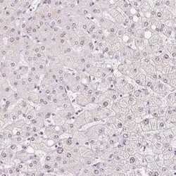 CCDC49 Antibody, Novus Biologicals:Antibodies:Primary Antibodies