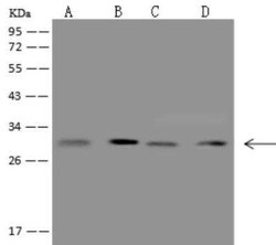 CCDC5 Antibody, Novus Biologicals 100 &mu;g; Unconjugated:Antibodies, Polyclonal