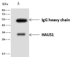 CCDC5 Antibody, Novus Biologicals 100 &mu;g; Unconjugated:Antibodies, Polyclonal