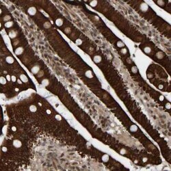 CCDC57 Antibody, Novus Biologicals 25 &mu;L, Unconjugated:Antibodies, Polyclonal