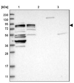 CCDC57 Antibody, Novus Biologicals 25 &mu;L, Unconjugated:Antibodies, Polyclonal