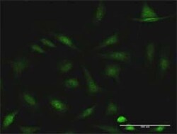 Novus Biologicals CCDC6 Antibody, Novus Biologicals 0.1 mg | Buy Online | Novus Biologicals&trade; | Fisher Scientific