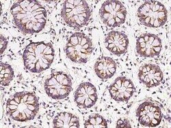 CCDC66 Antibody, Novus Biologicals:Antibodies:Primary Antibodies