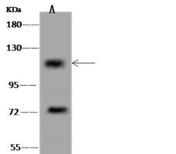 CCDC66 Antibody, Novus Biologicals:Antibodies:Primary Antibodies