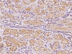 CCDC67 Antibody, Novus Biologicals:Antibodies:Primary Antibodies
