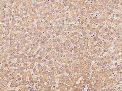 CCDC67 Antibody, Novus Biologicals:Antibodies:Primary Antibodies
