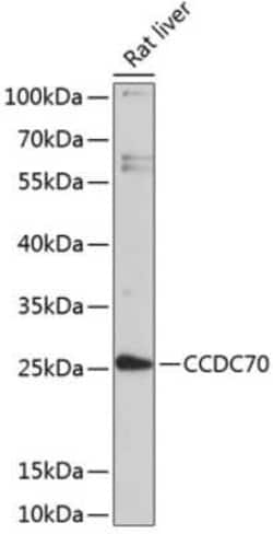 CCDC70 Antibody - BSA Free, Novus Biologicals 0.02 mL, Unconjugated:Antibodies,