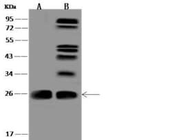 CCDC90B Antibody, Novus Biologicals 100 &mu;g; Unconjugated:Antibodies,