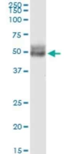 CCDC99 Antibody (2F4), Novus Biologicals 0.1 mg | Buy Online | Novus Biologicals | Fisher Scientific