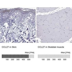 CCL27/CTACK Antibody, Novus Biologicals 100 &mu;g; Unconjugated:Antibodies,