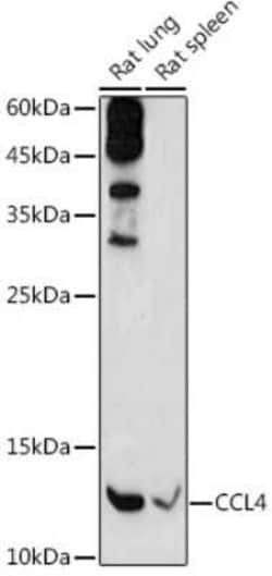 CCL4/MIP-1 beta Antibody - Azide and BSA Free, Novus Biologicals 100 &mu;g | Buy Online | Novus Biologicals | Fisher Scientific