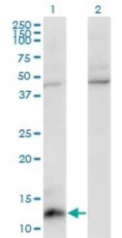 CCL7/MCP-3/MARC Antibody (4B5), Novus Biologicals 0.1 mg | Buy Online | Novus Biologicals | Fisher Scientific