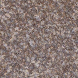 CCM2 Antibody, Novus Biologicals 25 &mu;L | Buy Online | Novus Biologicals | Fisher Scientific