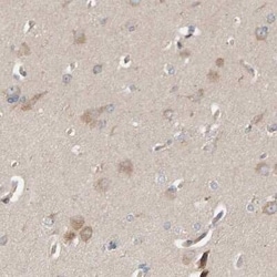 CCM2 Antibody, Novus Biologicals 25 &mu;L | Buy Online | Novus Biologicals | Fisher Scientific