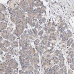 CCM2 Antibody, Novus Biologicals 25 &mu;L | Buy Online | Novus Biologicals | Fisher Scientific