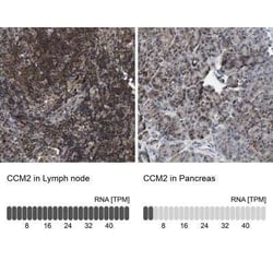 CCM2 Antibody, Novus Biologicals 25 &mu;L; Unconjugated:Antibodies, Polyclonal