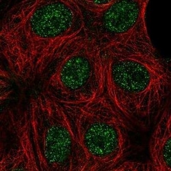 CCNK Antibody, Novus Biologicals 25 &mu;L; Unconjugated:Antibodies, Polyclonal