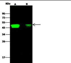 CCR1 Rabbit anti-Human, Clone: 2, Novus Biologicals 50 &mu;g; Unconjugated:Antibodies,