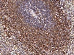 CCR1 Rabbit anti-Human, Clone: 3, Novus Biologicals 50 &mu;g; Unconjugated:Antibodies,